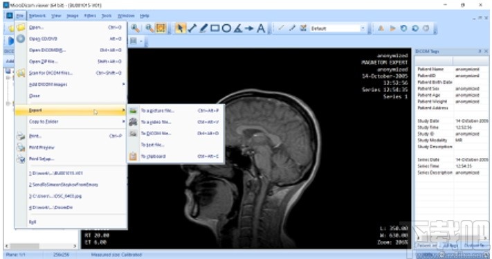 MicroDicom viewer(Dicom格式看图软件)