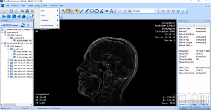 MicroDicom viewer(Dicom格式看图软件)