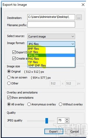 MicroDicom viewer(Dicom格式看图软件)