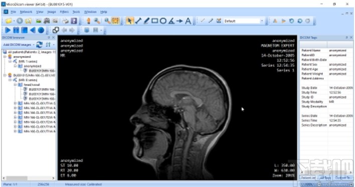 MicroDicom viewer(Dicom格式看图软件)