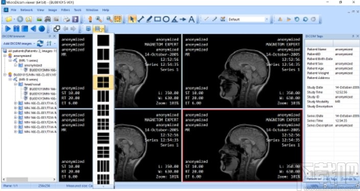 MicroDicom viewer(Dicom格式看图软件)