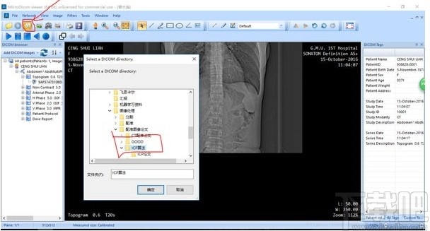 MicroDicom viewer(Dicom格式看图软件)