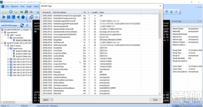 MicroDicom viewer(Dicom格式看图软件)