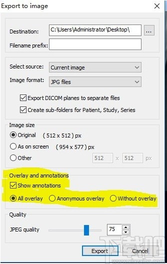 MicroDicom viewer(Dicom格式看图软件)