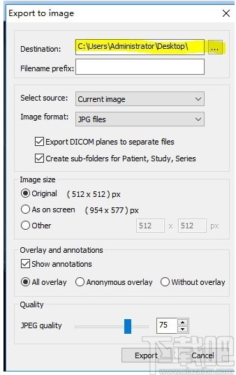 MicroDicom viewer(Dicom格式看图软件)