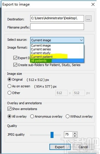 MicroDicom viewer(Dicom格式看图软件)