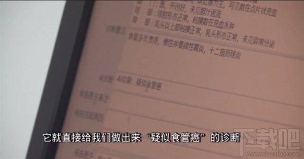 腾讯觅影是什么产品？腾讯觅影有什么用？