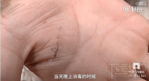 国行iPhone7首炸事件 苹果中国：等待总部回复