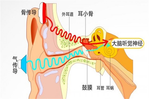 酷似发箍的骨传导耳机 戴起来有点傻